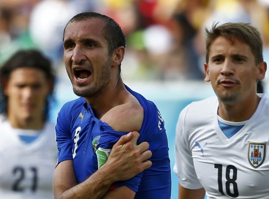 Italy's Giorgio Chiellini shows his shoulder, claiming he was bitten by Uruguay's Luis Suarez, during their 2014 World Cup Group D soccer match at the Dunas arena in Natal