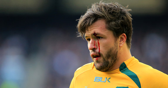 Will Australia be hurt again?: Adam Ashley-Cooper suffers during the England game. The Wallabies could fall again
